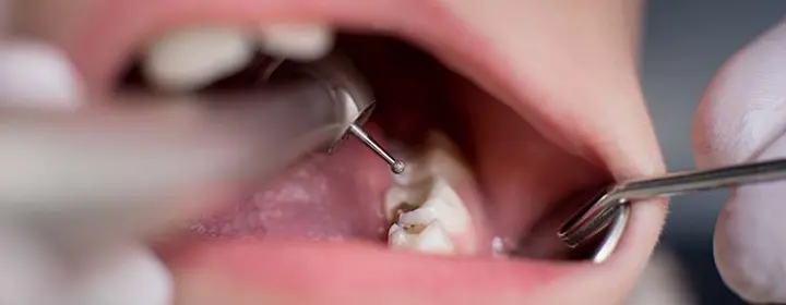 Restorative Dentistry